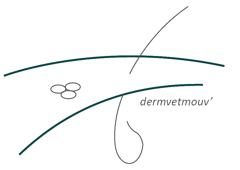 Diagnostic expérimental des dermatophyties : la lumière de Wood et l'examen  des poils et des squames